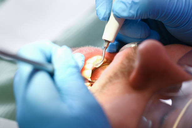 Best Emergency Orthodontic Repairs in San Clemente, CA